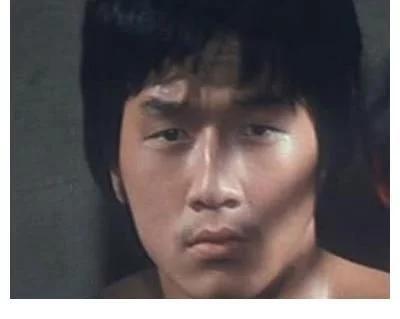 探尋小巷中的美麗秘密，割雙眼皮的價(jià)格是否昂貴？